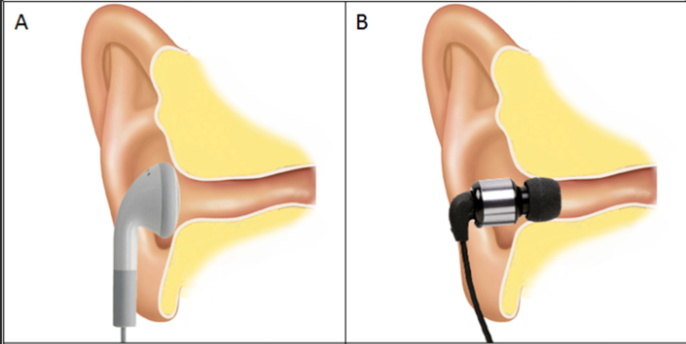 Diagram illustrating the differing fits of IEMs and earbuds.